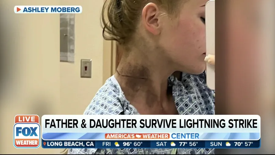 Father and daughter on surviving lightning strike after being temporarily paralyzed
