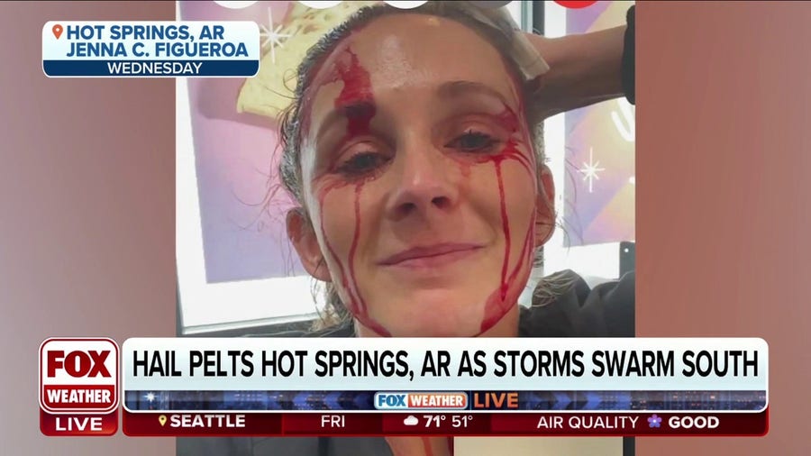 Softball-sized hail strikes Arkansas woman on her head