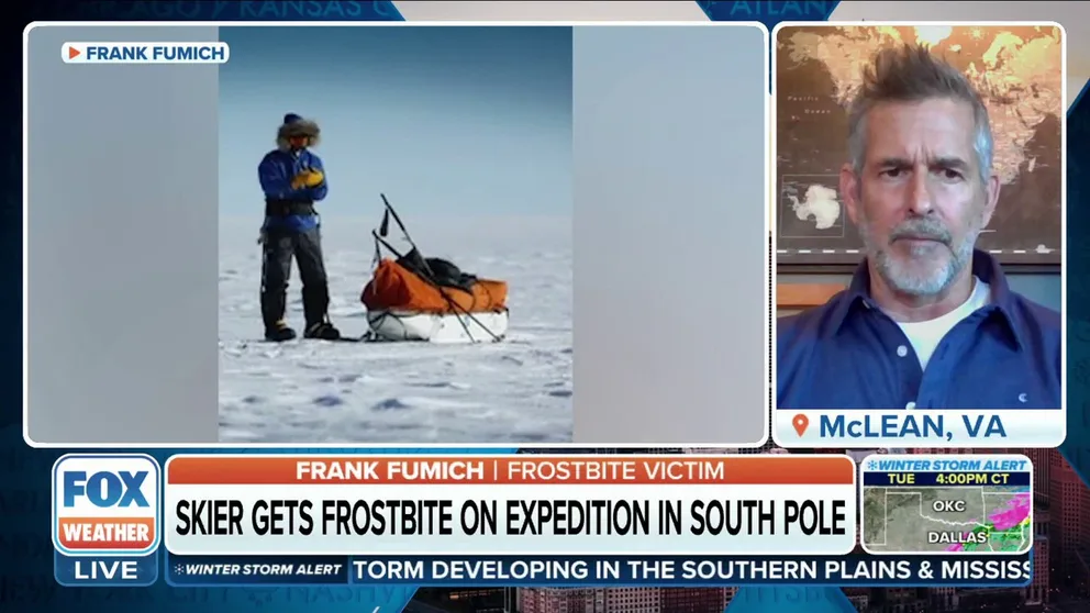 Skier Frank Fumich joins FOX Weather to discuss his experience getting frostbite twice.   