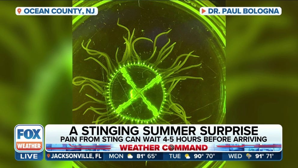 A dangerous clinging jellyfish has been found in the waters off the Jersey Shore. Montclair State University professor Dr. Paul Bologna joined FOX Weather on Monday to explain why these jellyfish can be dangerous.