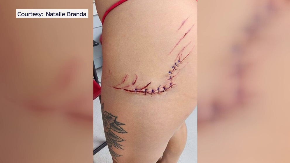A Florida woman is recovering after being bitten by a shark near the St. Petersburg Pier over the weekend.