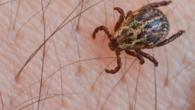 A tick crawling on the hairy arm of a man before going for blood.