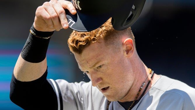 Sweat drips from the brow of New York Yankees Outfielder Clint Frazier #77 in Toronto, ON., Canada July 08, 2018.