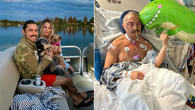 Photos show JC Defeats and his wife, Christine, before the gator attack on the left and JC after the attack on the right.