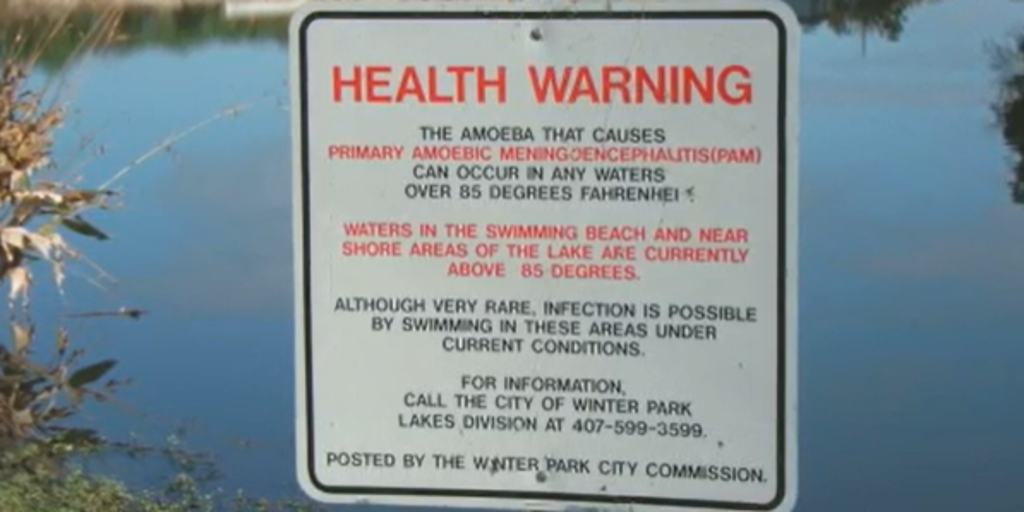 Health officials warn of deadly brain-eating amoeba as summer approaches