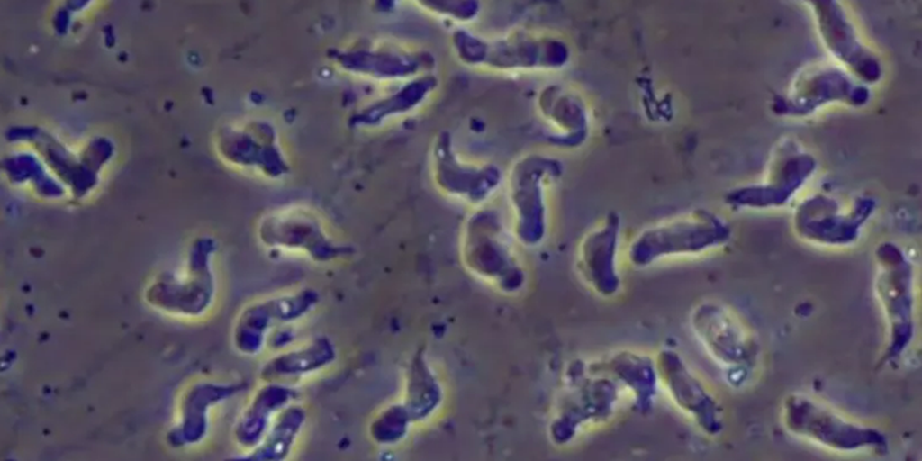 North Carolina teen critically injured by rare brain-eating amoeba