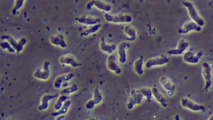 North Carolina teen critically injured by rare brain-eating amoeba