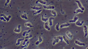 North Carolina teen critically injured by rare brain-eating amoeba