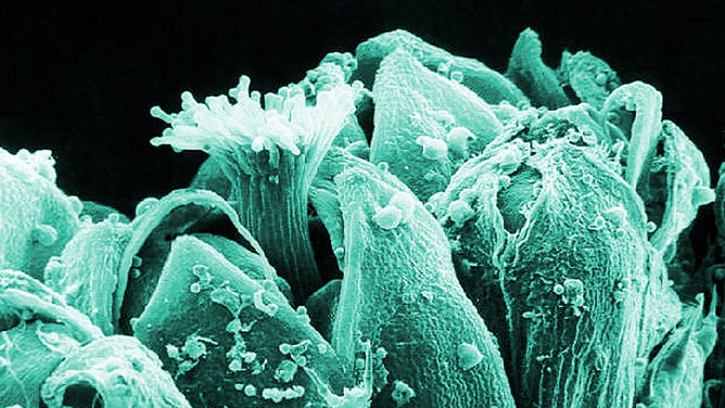 A scanning electron micrograph of a ragweed plant and its pollen.