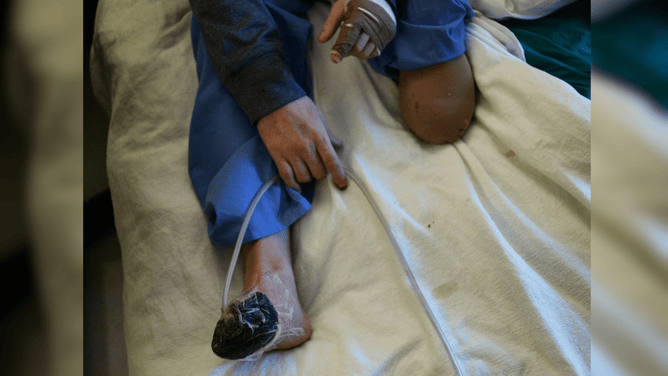 An oil field worker got frostbite on his feet, legs and hands while working in sub-freezing temperatures on the oil fields.