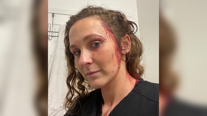 Figueroa with her injury. June 14, 2023.