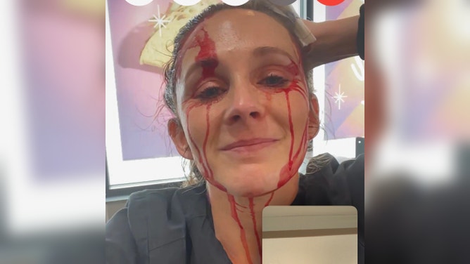Figueroa with her injury, which she is showing to her family on a video call. June 14, 2023.