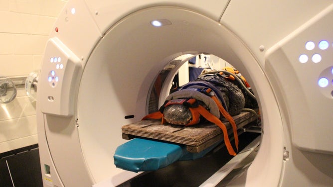 Treating a nearly 400 pound alligator