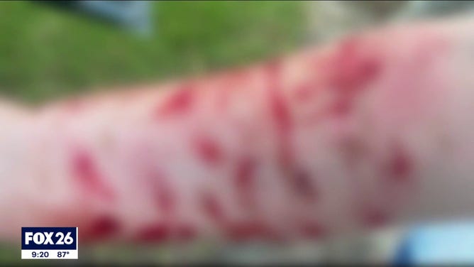 A blurred image showing wounds a Texas woman suffered after she was attacked by a snake and hawk at the same time.