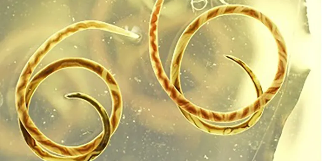 Parasitic worm that can enter brain found in Atlanta, researchers say