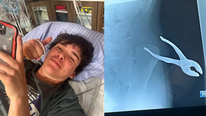 Joey Zeman was impaled by his pliers after he slipped and fell on ice.