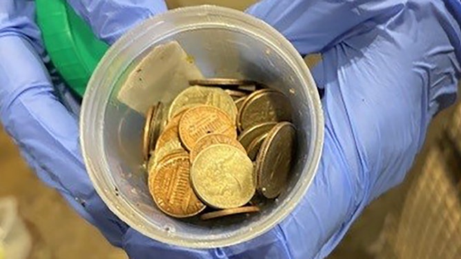 The team identified 70 U.S. coins in Thibodaux's stomach.