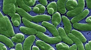 Study finds flesh-eating bacteria, harmful algal blooms in Long Island waters as quality worsens