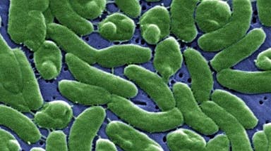 Deadly infection: Florida reports first rare, flesh-eating bacteria death of the year