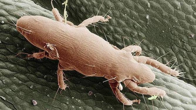 Electron Microphotograph of Oak Itch Mite.