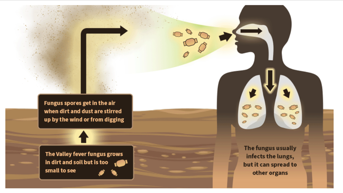 Path of fungus to infect a human.