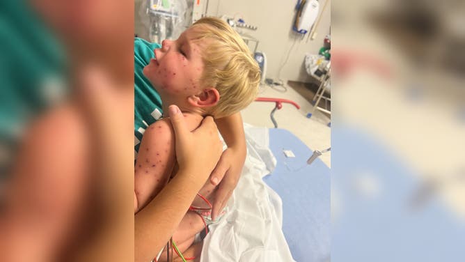 Beckham in the hospital after the yellowjacket stings.