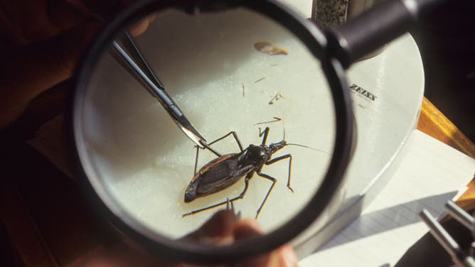 Chagas Disease photo