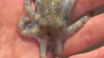 Man vacationing unknowingly grabs one of the world's deadliest animals - Fox News