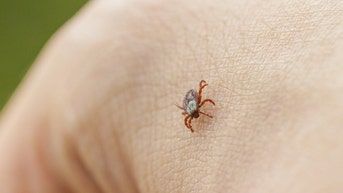 Deadly tick-borne disease that can cause brain damage is spreading across the US - Fox News