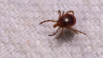 First case of rare, potentially fatal tickborne virus confirmed in New York state