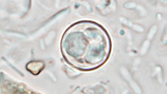 Nasty, diarrhea-causing parasite spreading across US ahead of holiday weekend - Fox News