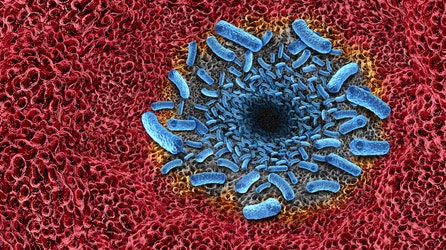 Flesh-eating bacteria death toll reaches double digits across US as infections surge