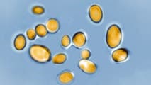 Potentially life-threatening fungus rapidly spreading across the U.S. with limited treatment options