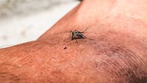 Health alerts issued as cases of painful illness typically found in tropical countries spreads across Florida