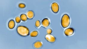 Potentially life-threatening fungus rapidly spreading across the US with limited treatment options