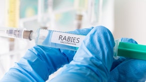 CDC warns of rising rabies exposures across the US as deadly disease threat grows