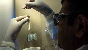A nightmare, drug-resistant skin fungus is spreading at alarming rate - Fox News
